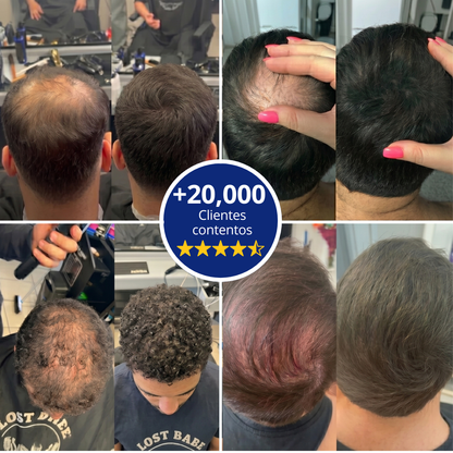 Follicle™ - Rellenador Capilar